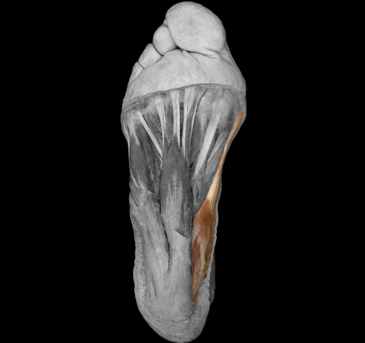 <p>origin: calcaneus, plantar aponeurosis, flexor retinaculum </p><p></p><p>insertion: medial side of proximal phalanx of big toe </p><p></p><p>action: abduct, flex big toe </p><p></p><p>innervation: medial plantar nerve </p>