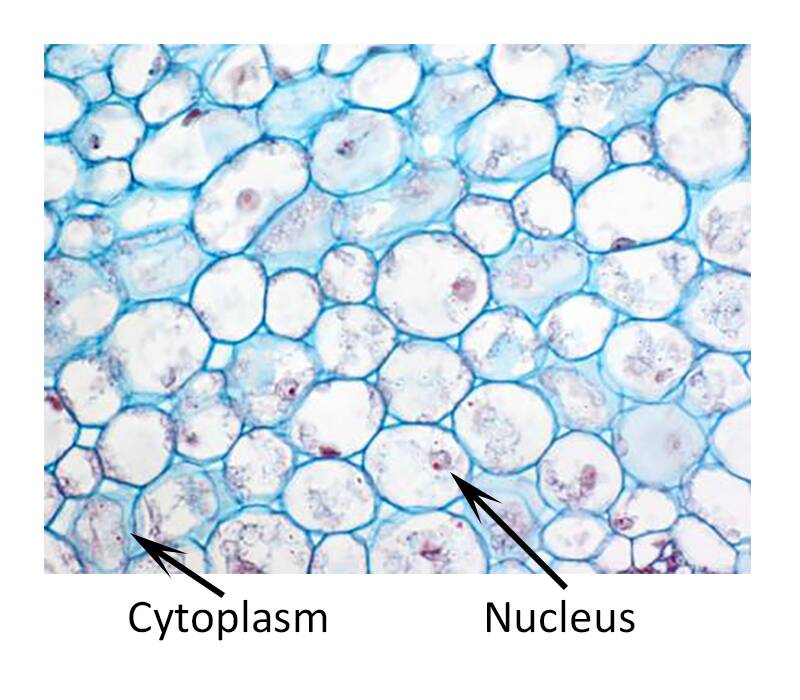 <p>The most common type. These cells are thin-walled and capable of photosynthesis when they contain chloroplasts. They are involved in producing sugar during photosynthesis and they can store food</p>