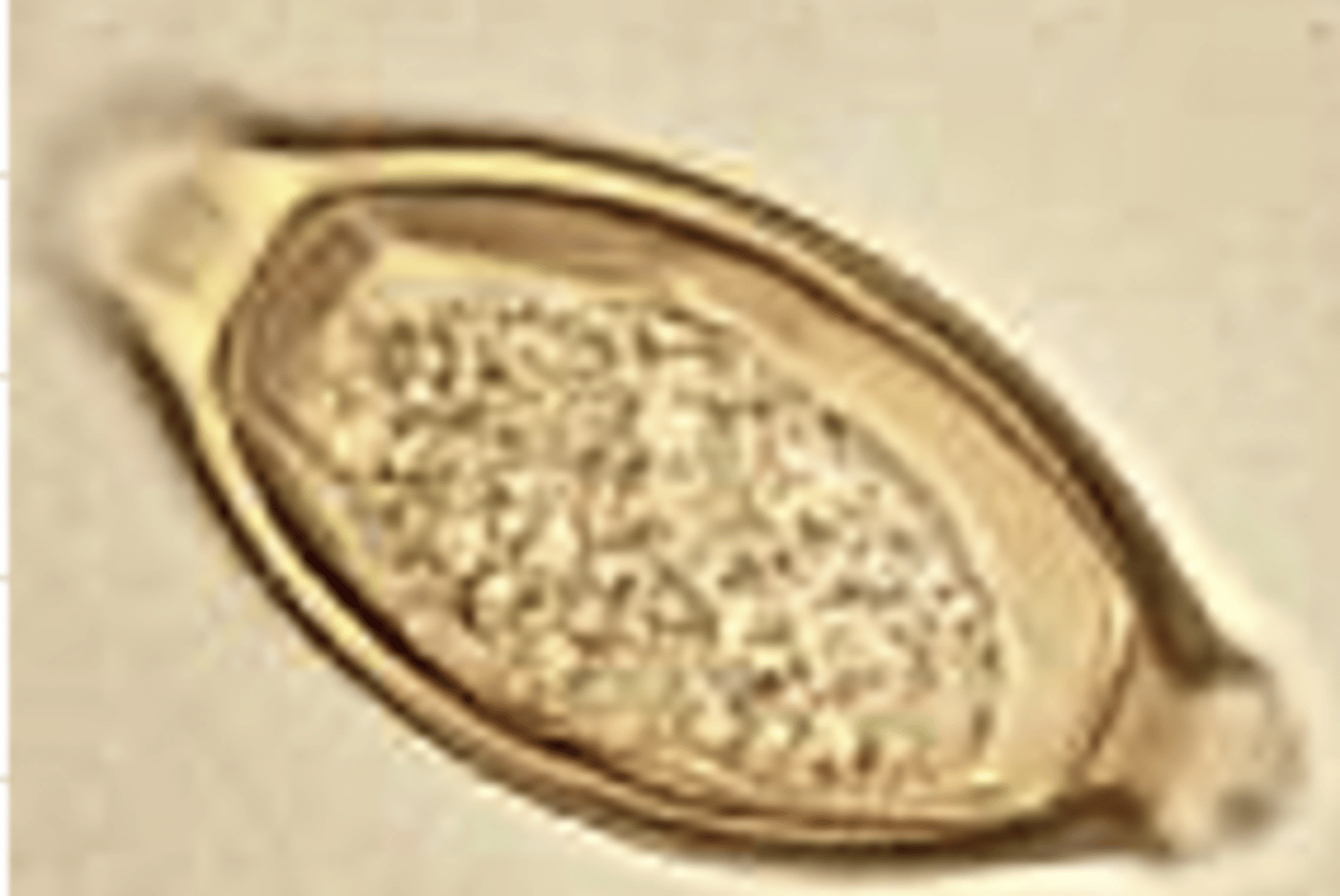 <p>this egg belongs to the genus _____</p>