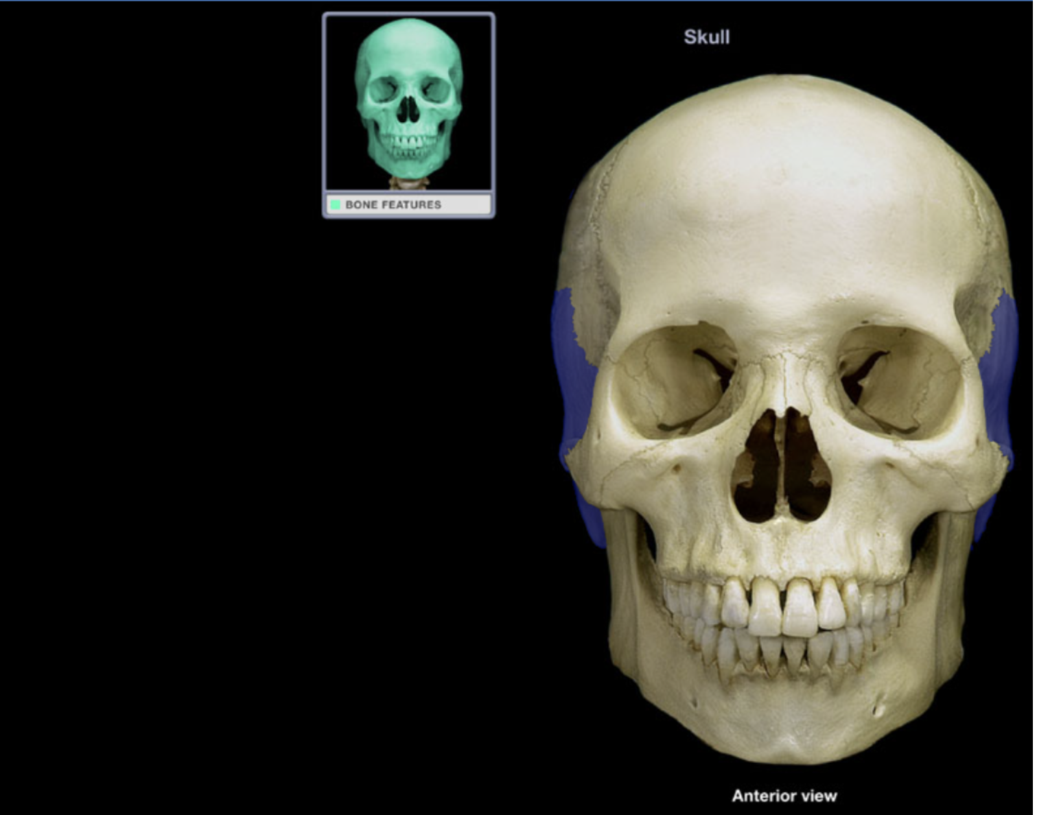 <p>Parietal bone</p>