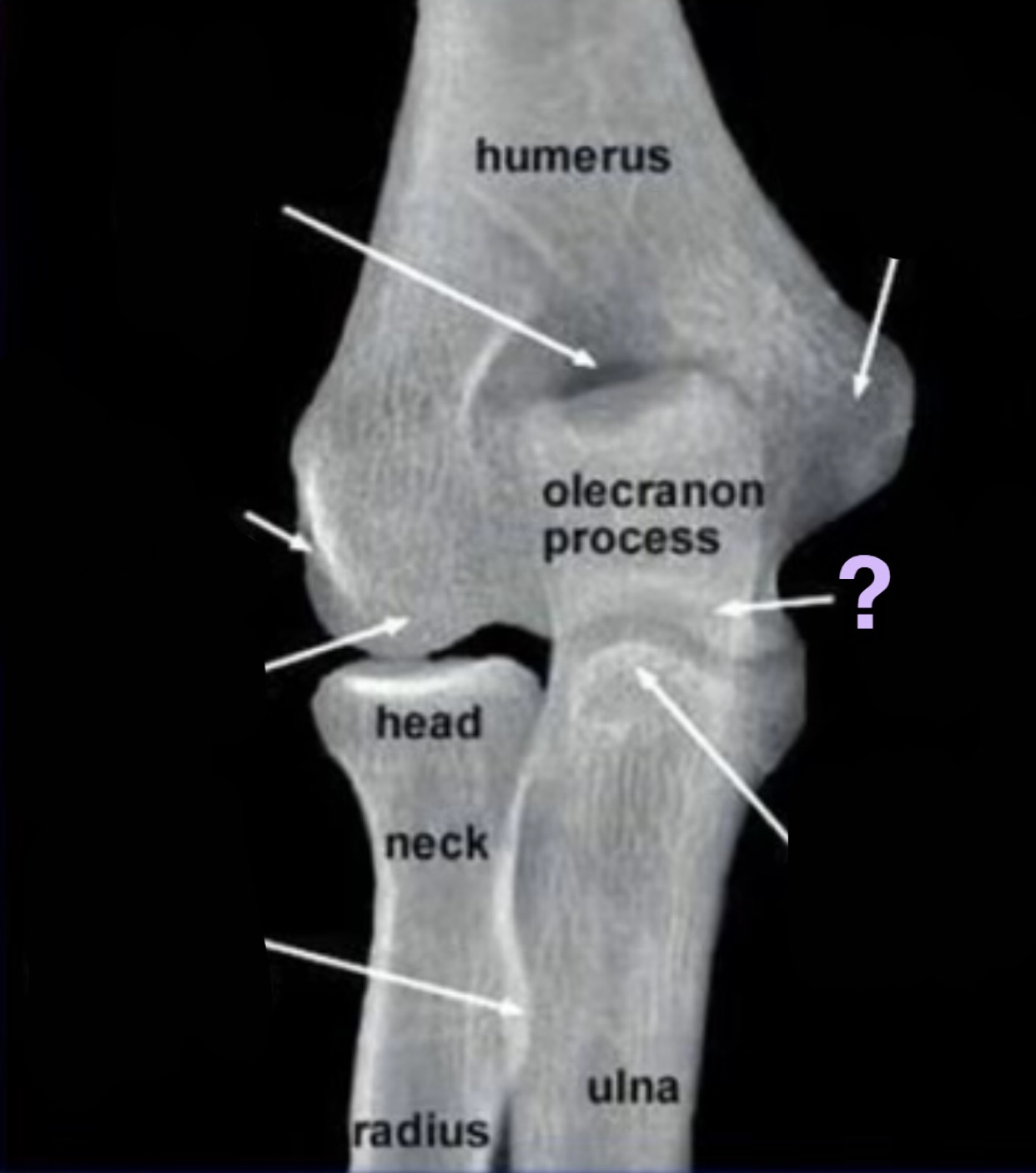 term image
