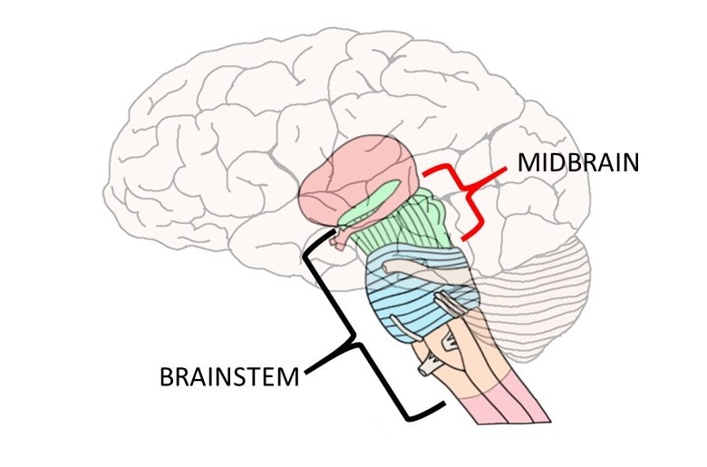 <p>Midbrain</p>