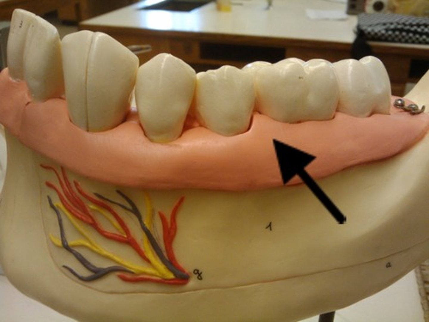 <p>soft tissue surrounding teeth sockets &amp; necks of teeth</p>