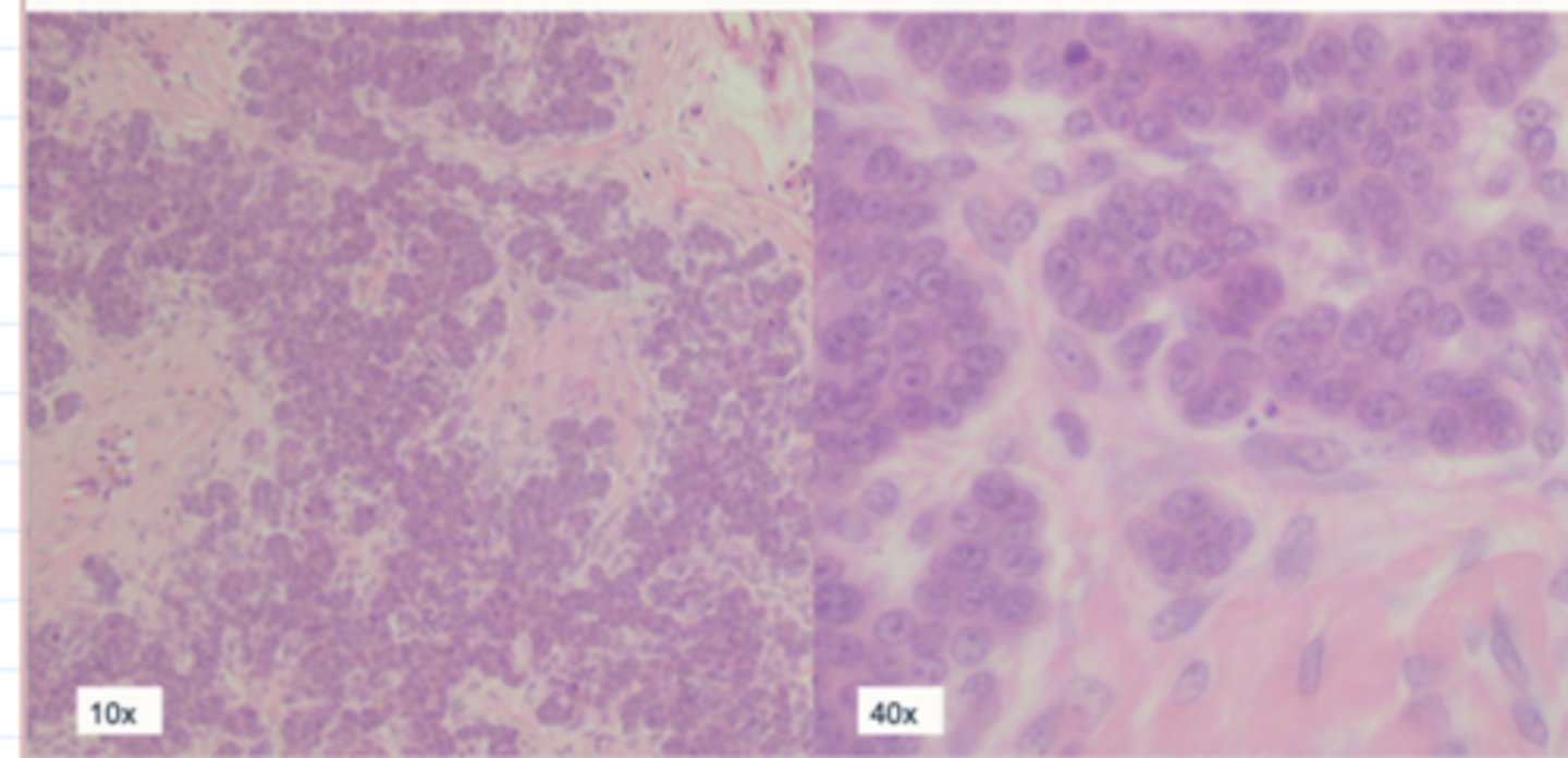 <p>Case 3 Histopathology</p><p>why would you send this ?</p>