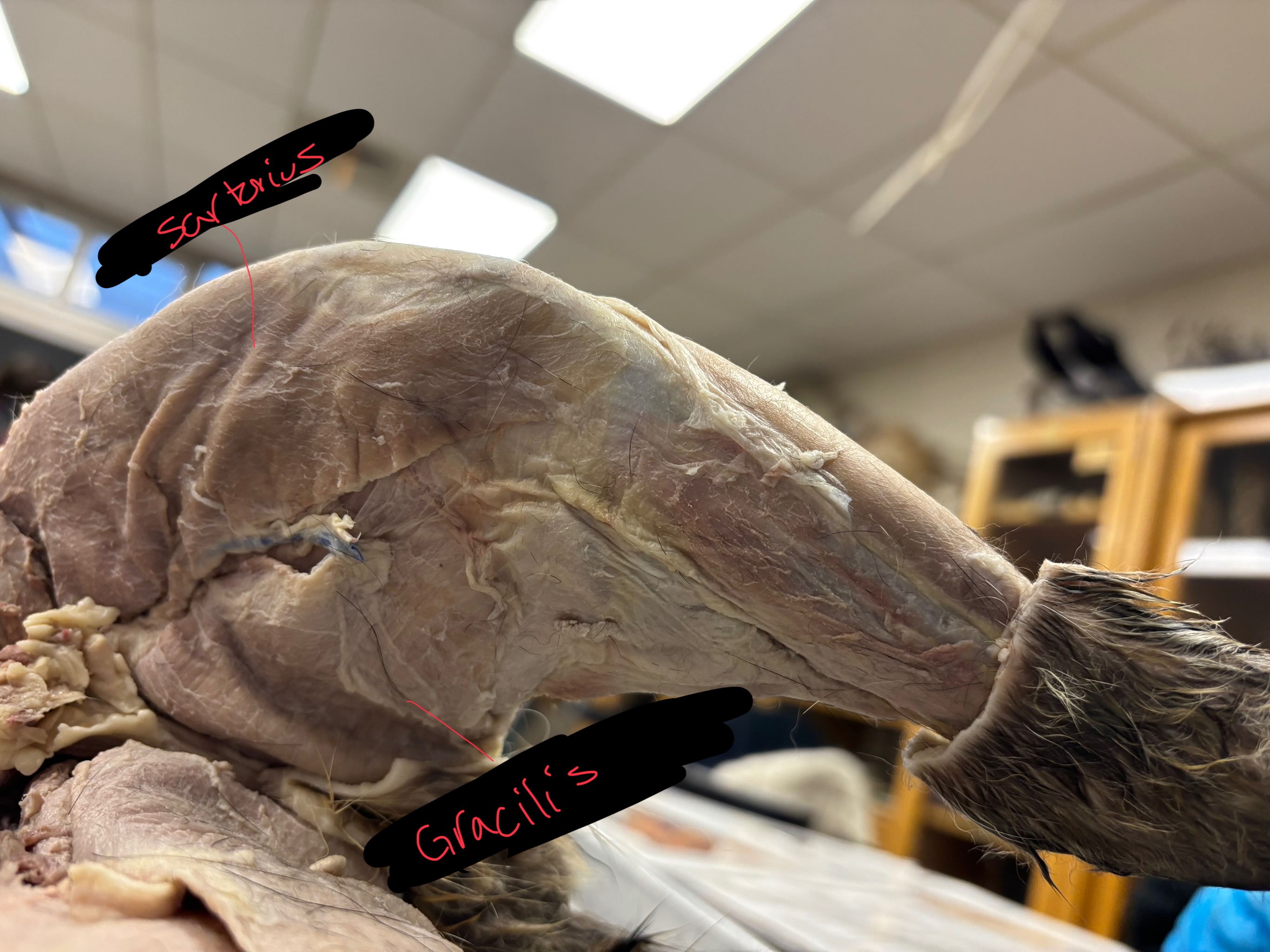 <p>Gracilis: adducts and flexes lower leg</p><p>Sartorius: adducts and rotates thigh, extends lower leg</p>