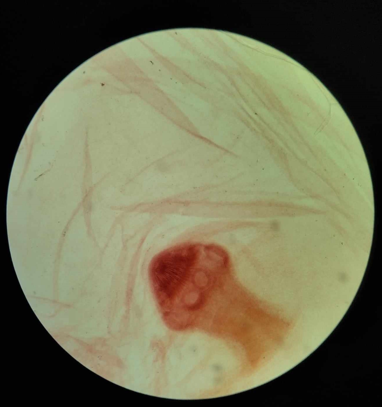 <p>name of larval stage and of which parasite? </p>