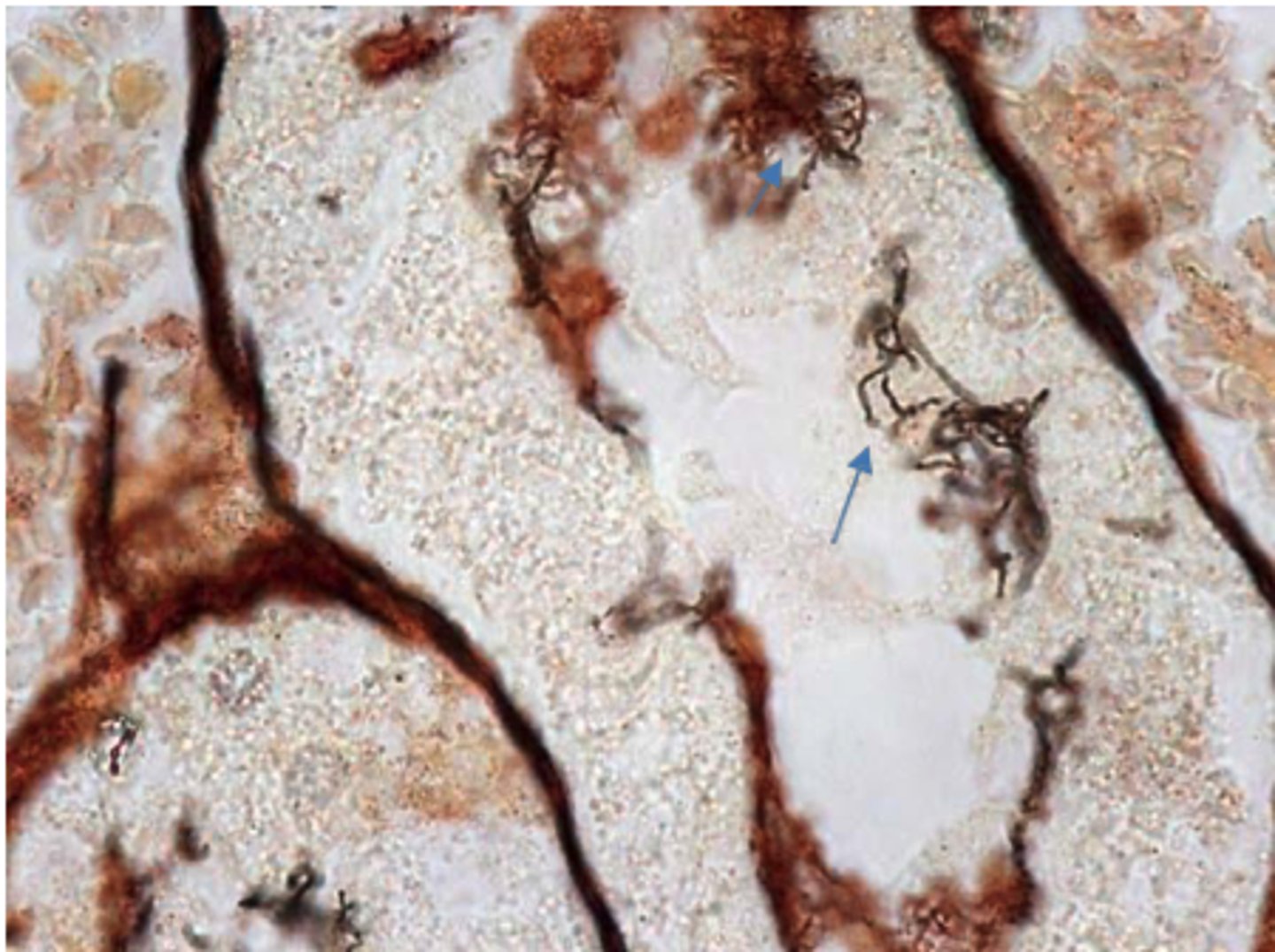 <p>A silver-stained section of a kidney from a sow</p>