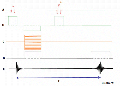 <p><span><strong>Letter F in Image 76 represents:</strong></span></p>