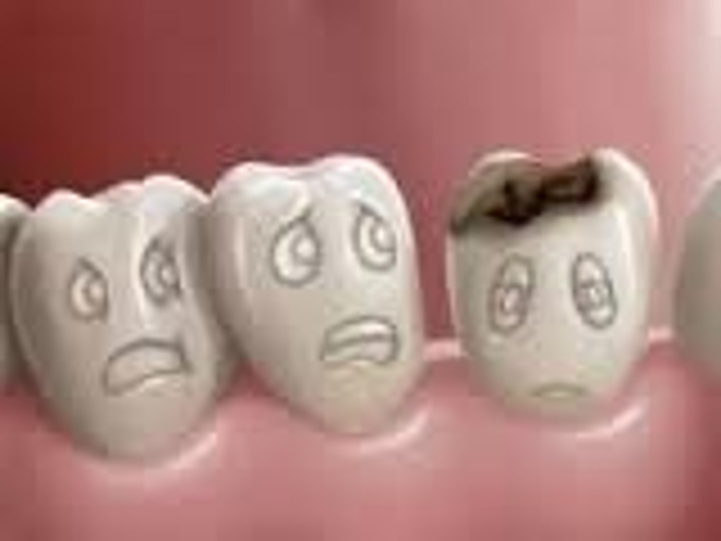 <p>you have a cavity</p>