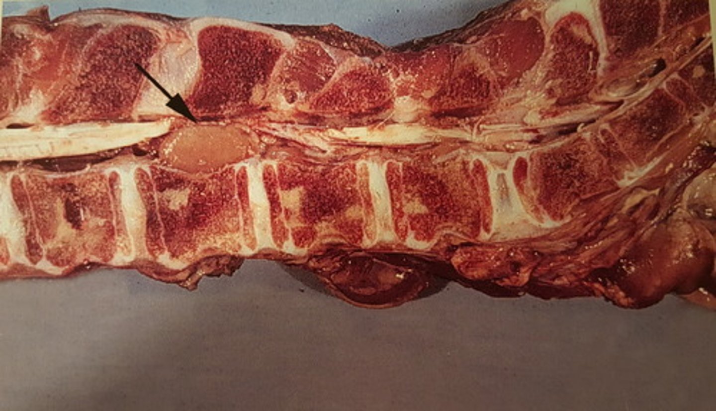 <p>Rygsøjle fra okse. Patoanatomisk diagnose?</p>