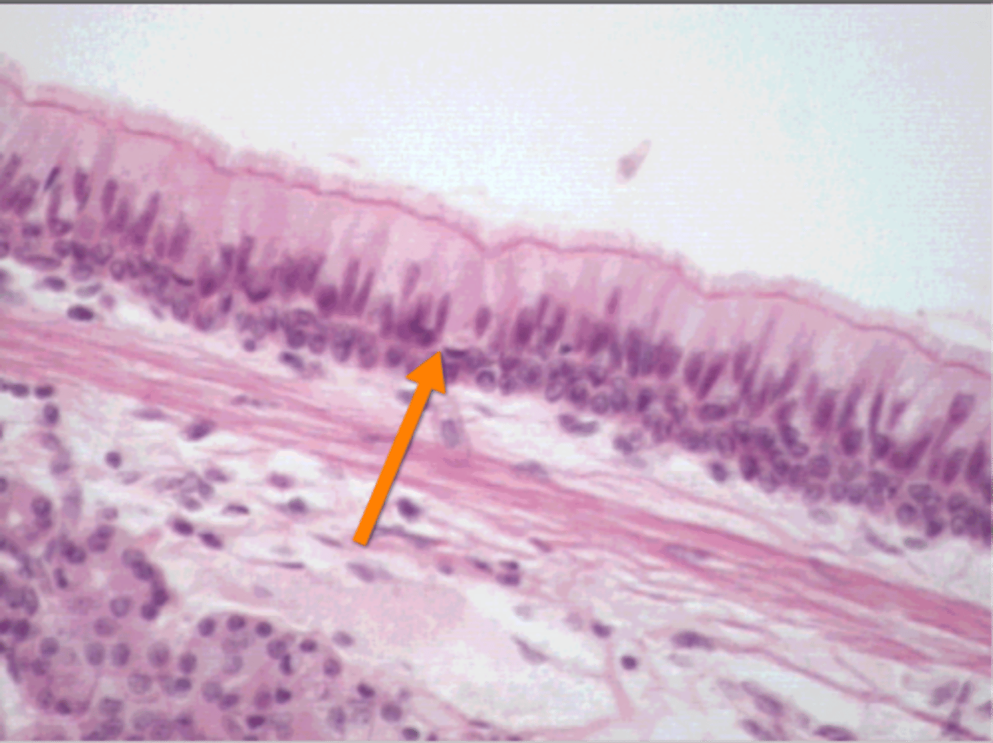 <p>what type of tissue is this?(respiratory)</p>