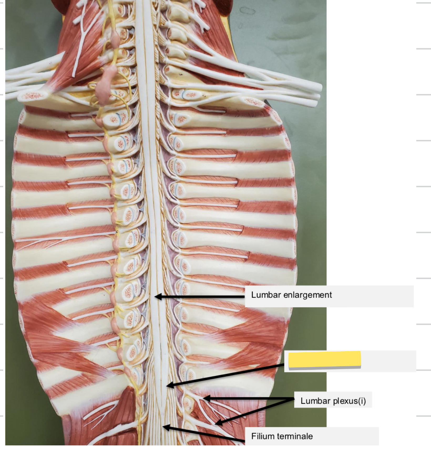 <p>Name this part</p>