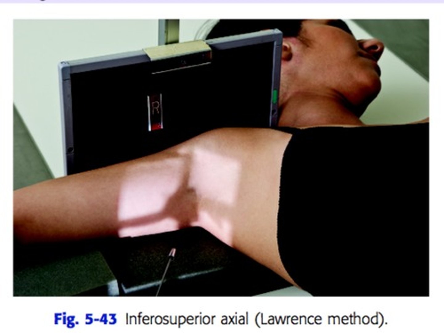 <p>Patient is supine with should raised about 2 inches from table top using a sponge. Place cart at edge of table to support forearm. IR at top of shoulder, patient head turned .</p><p>CR - 25-30 degree into axilla</p>