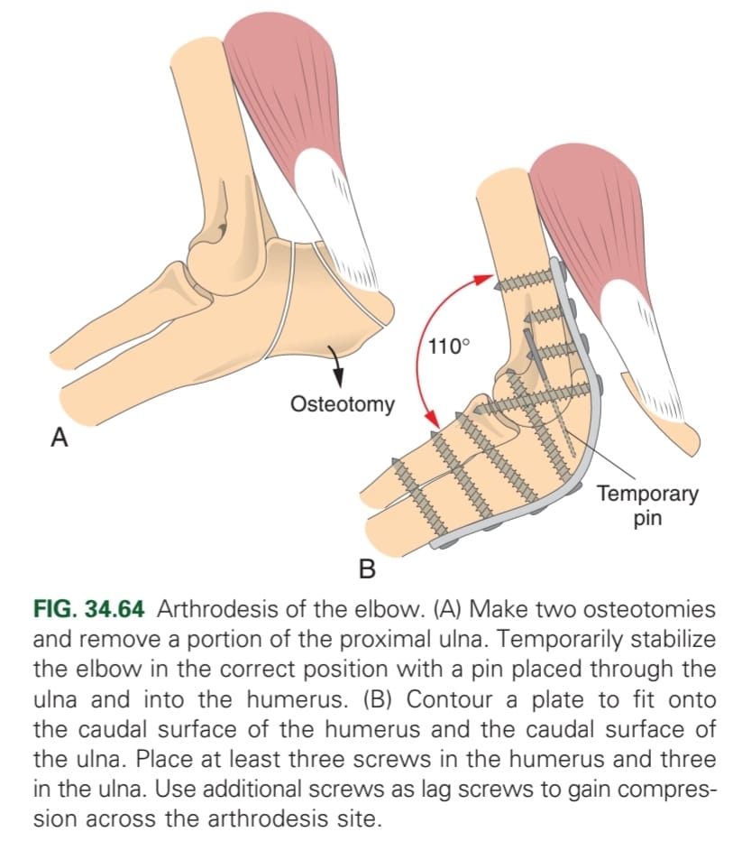 <p>Arthrodesis and arthrotomy</p>