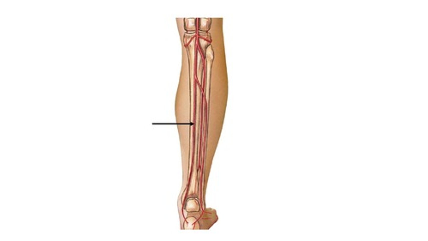 <p>Name the blood vessel.</p>
