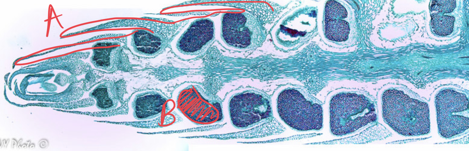 <ul><li><p>which organism is this?</p></li><li><p>what structure?</p></li></ul><p>a. what does the structure bear?</p><ul><li><p>label slide</p></li></ul>