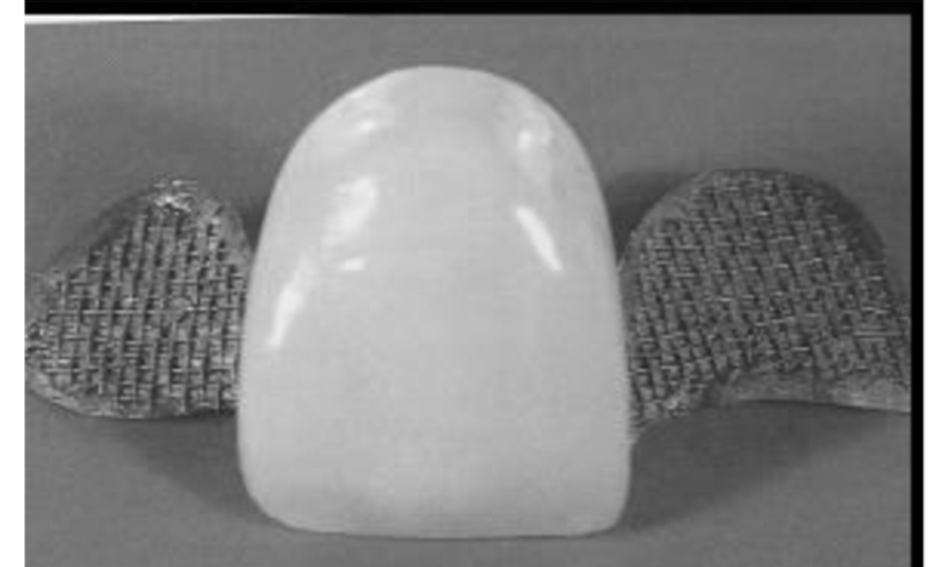 <p>In this design, they use a non-etching method to produce metal surface roughness before the alloy is cast </p>