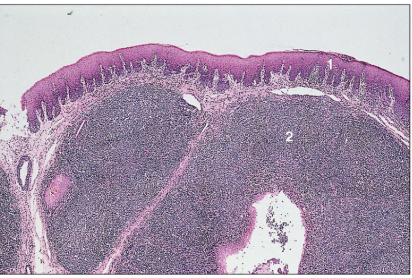 <p>tonsil, dog</p>