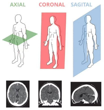 <p>En la tomografía siempre se obtienen de manera axial, pero la computadora calcula los aspectos del plano coronal y sagital.</p>