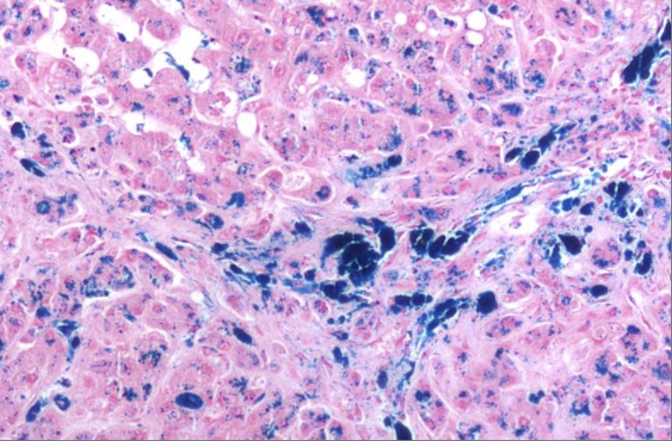 <p>ID the stain type </p>