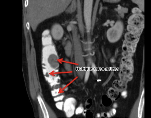 <p>What is this and what type of scan </p>