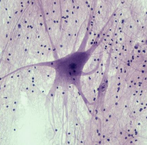 <p>Identify this nervous tissue, its location, and its function.</p>