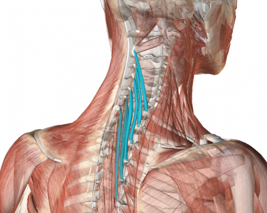 <p>Semispinalis Cervicis</p>