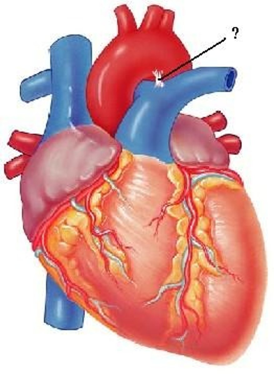 <p>ligamentum arteriosum</p>