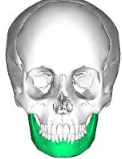 <p>What bone of the skull is this?</p>