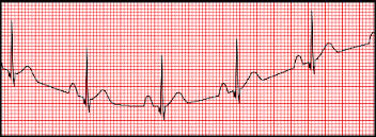 <p>D. Remind the patient to remain as still as possible.</p>