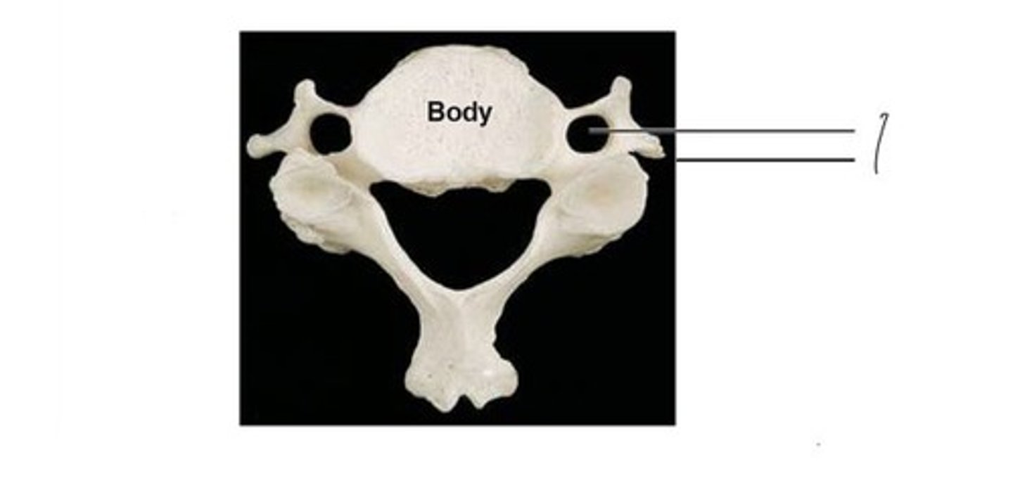 <p>What bone is this?</p>