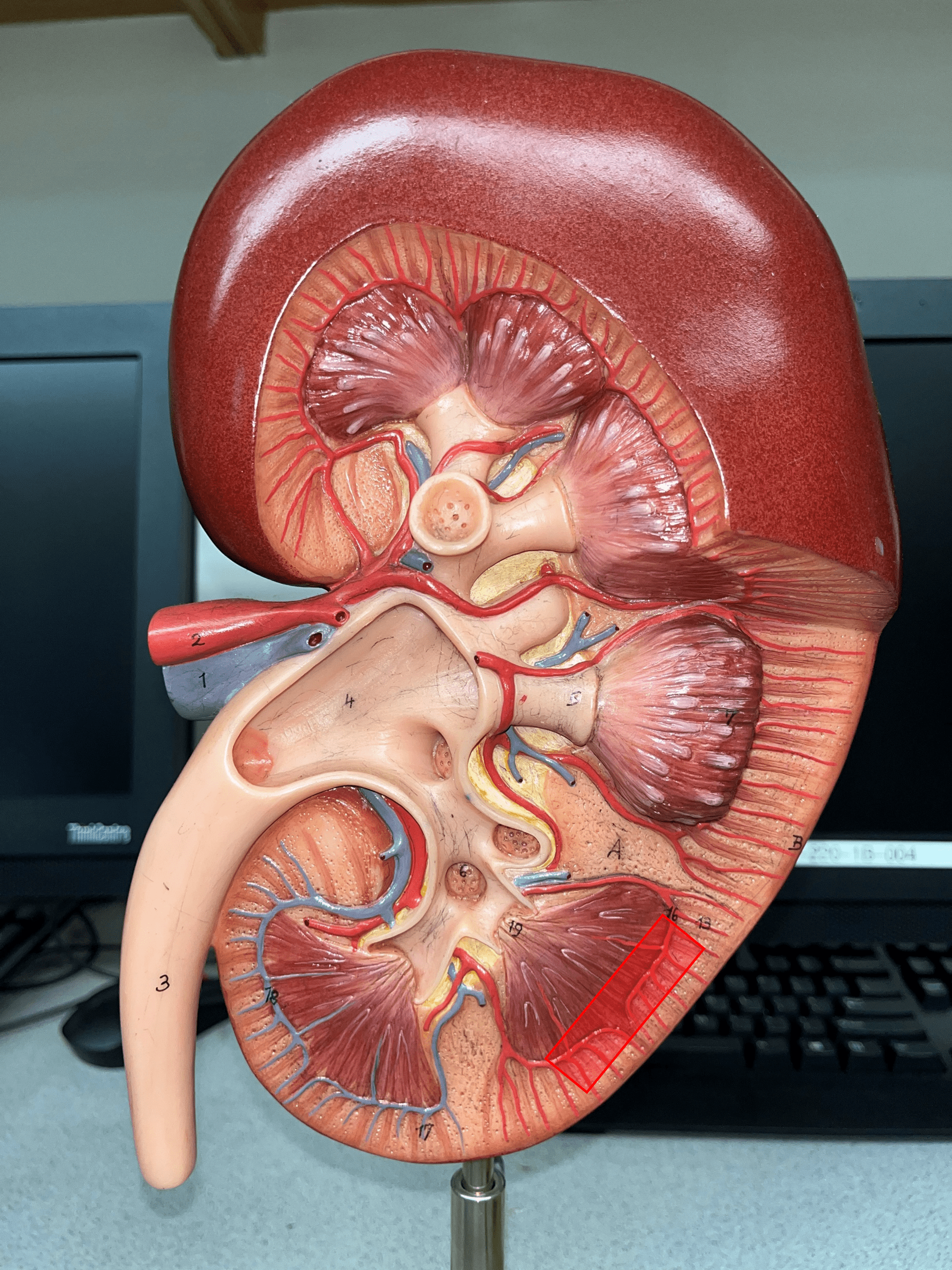 • Extends along the base of the renal pyramids.

• Branches of an interlobar a.

• Branches into smaller interlobular aa.