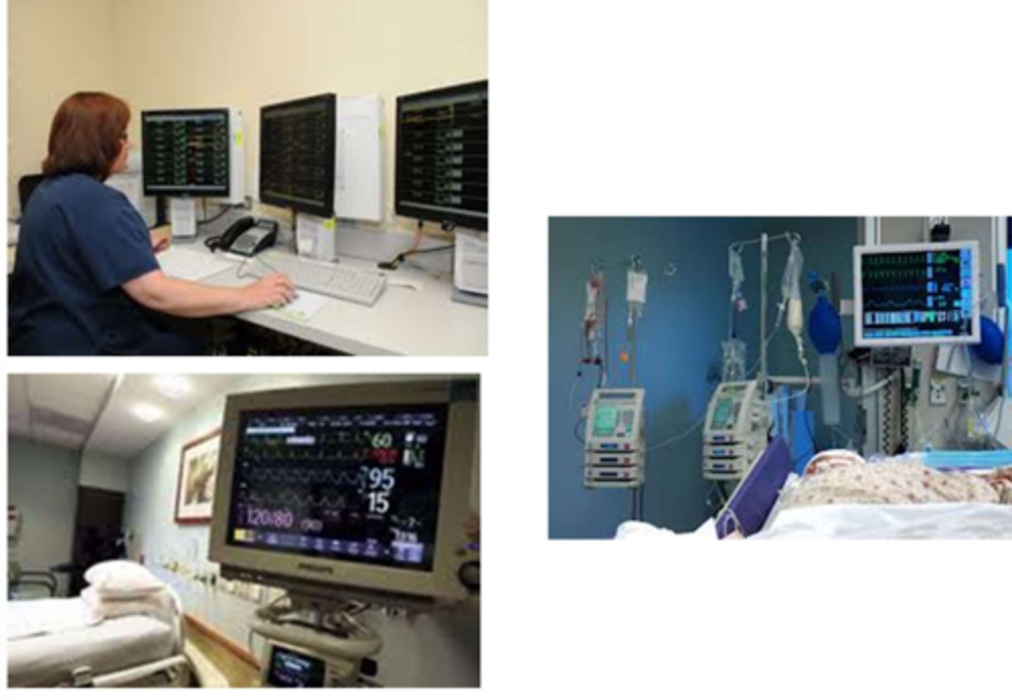 <p>Monitored at a distant site; continuous monitoring of HR and rhyhtm and RR via ECG.</p>