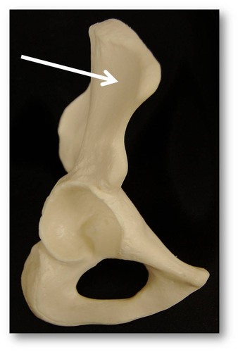 Name this specific region of the pelvic bone.