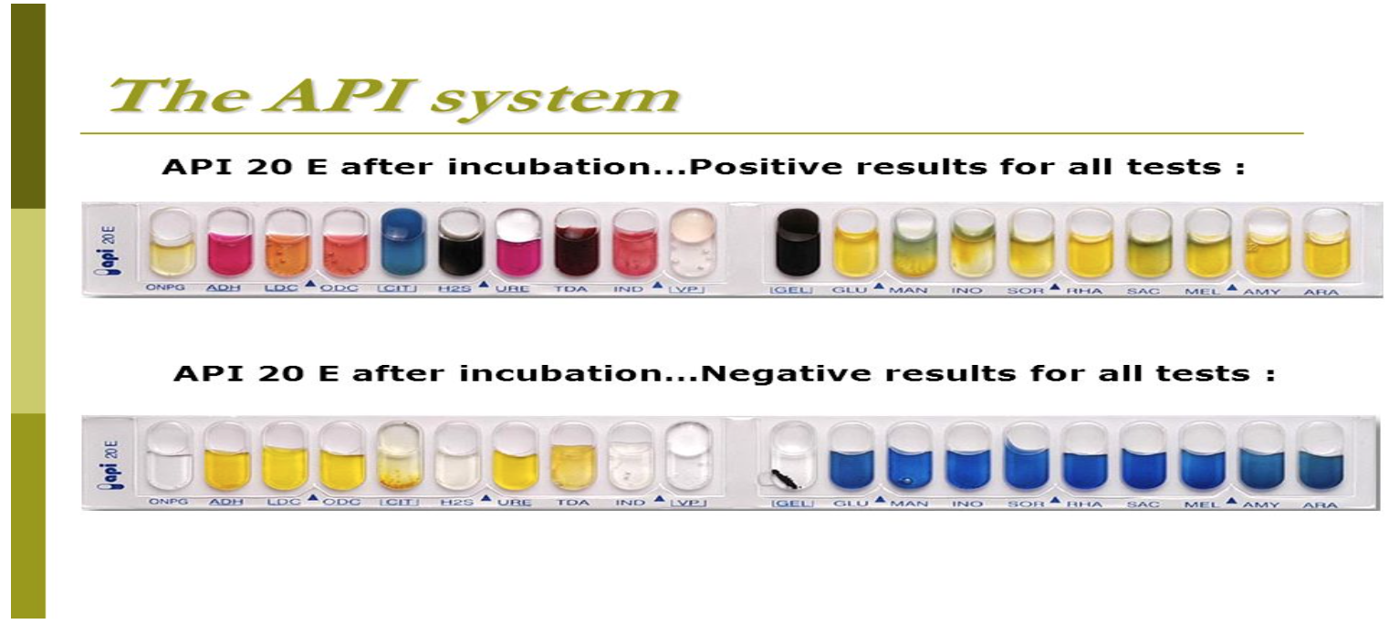 <ol><li><p><span><span>Compare the reaction in each well to the positive and negative controls in the picture. Write a + or – above each well in the score sheet shown here to score the reactions</span></span></p></li><li><p>For each set of three wells, add up the numbers indicated inside each positive well and enter that total in the oval bubble below each set of wells</p></li><li><p>When finished, the values in each bubble combine to form a seven-digit code</p></li><li><p>Compare the seven-digit code with the codes provided by the manufacturers to identify the microbe</p></li></ol><p></p>