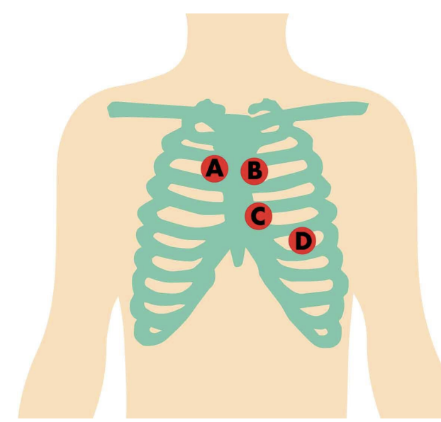 <p>name the heart sound in region B</p>