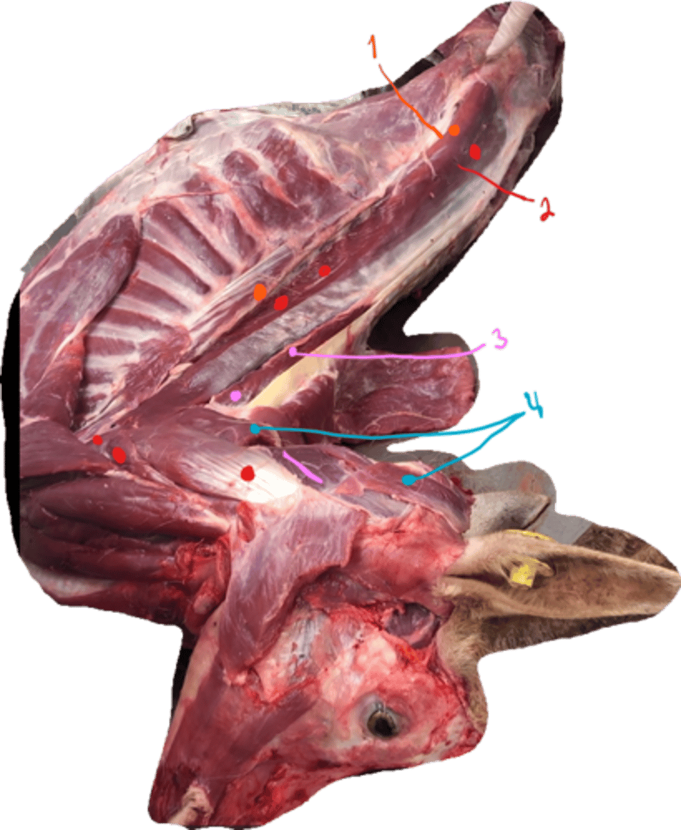 <p>what type of muscles are these? what muscle do we not see as it is too deeply located?</p>