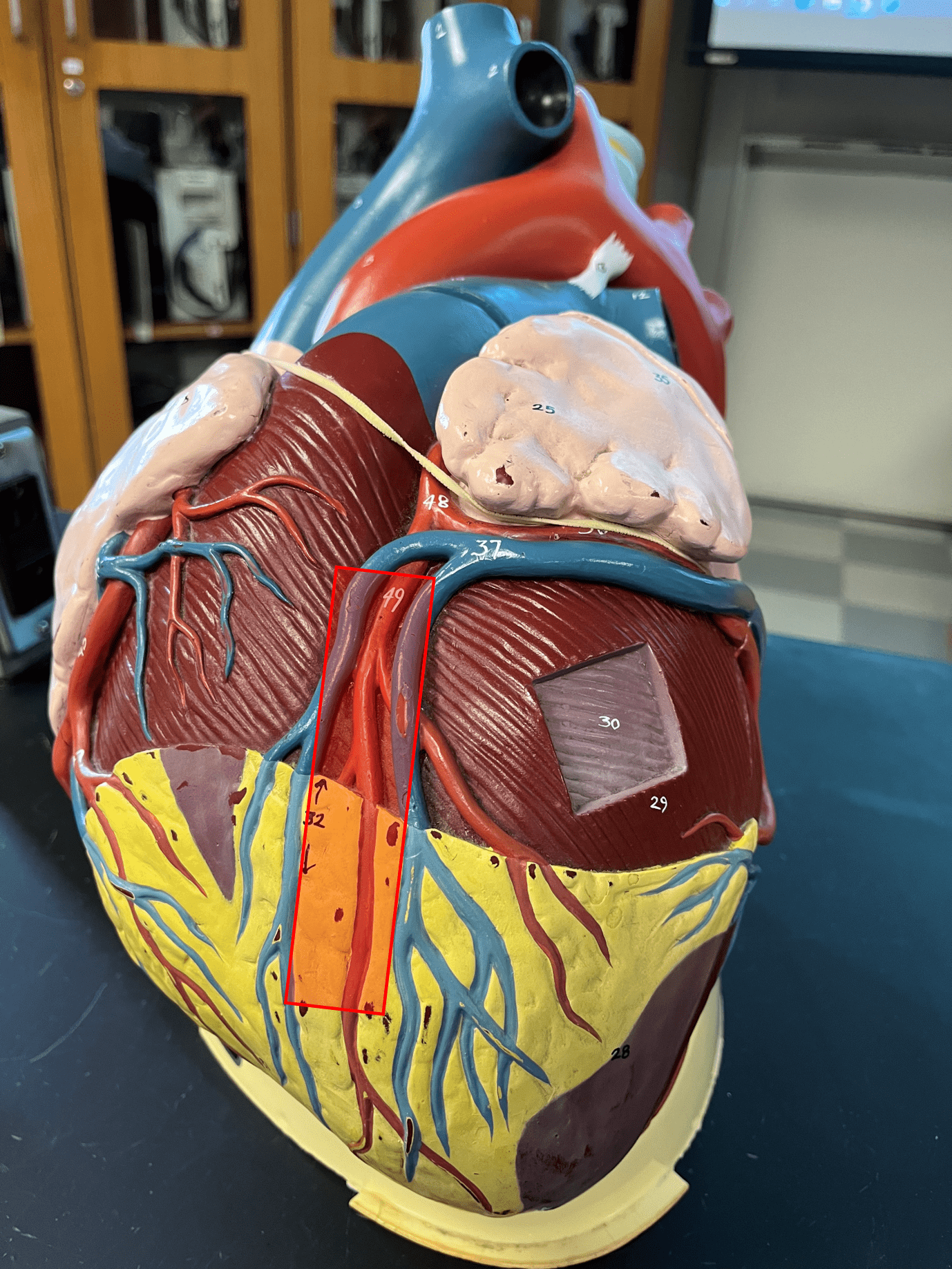 • Part of the coronary circulation.

• Located in and supplies the tissue around the anterior interventricular sulcus.

• One of the branches of the left coronary artery.