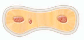 <p><span><strong><span>marked by two or three canal openings without visible connections.</span></strong></span></p>