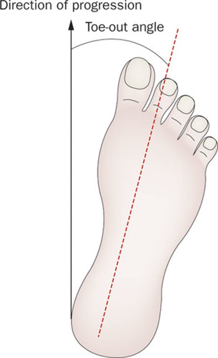 <p>Amount of toe out. average is 5-7 degrees</p>
