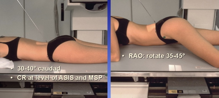 <p>What position is this?</p>