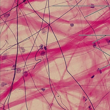 <p><strong>what is the connective tissue?</strong></p>