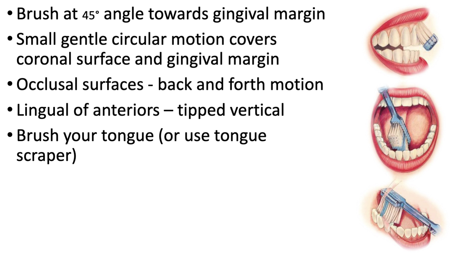 <p>modified bass technique </p>