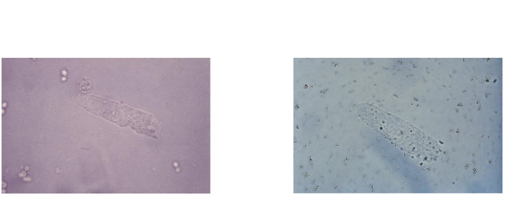 <p><span style="font-family: Arial, sans-serif">Hyaline Casts</span></p>