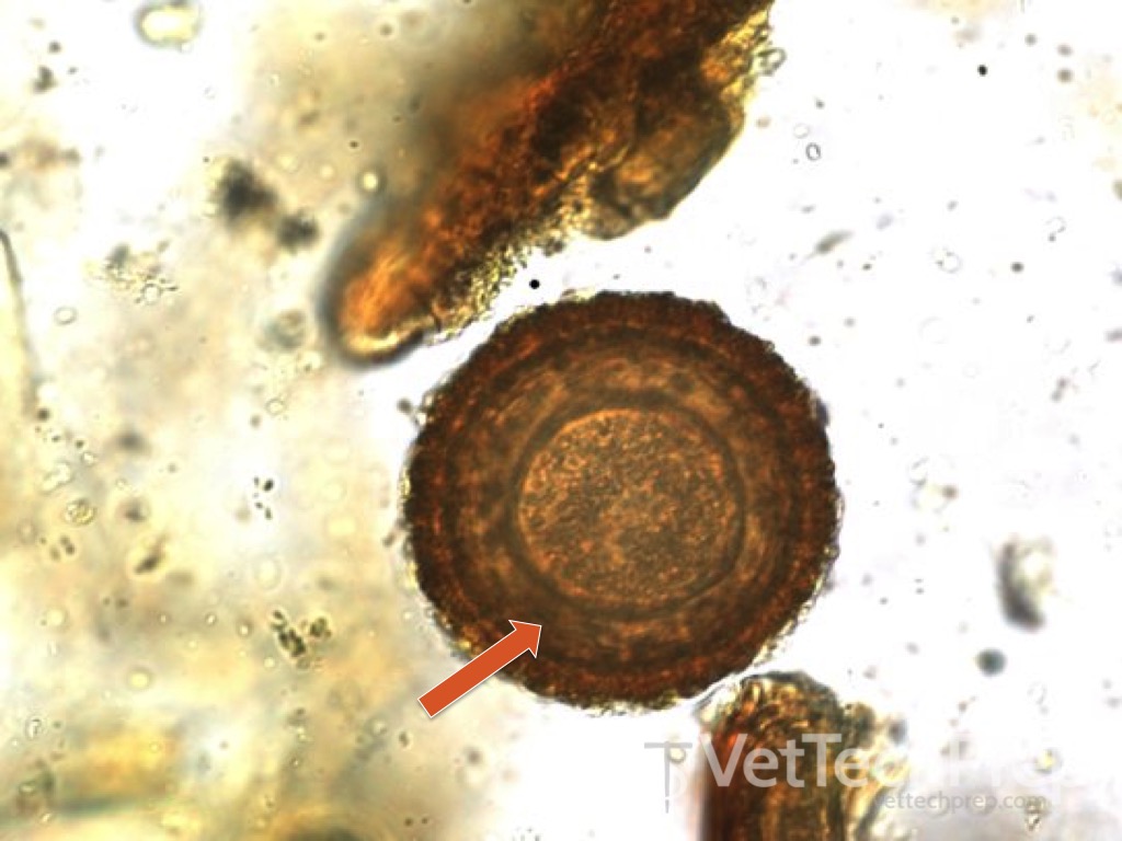 <p>what parasite is this?</p><p>whats the scientific name?</p>