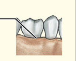 What structural category is this?

What functional category is this?