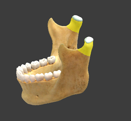 term image