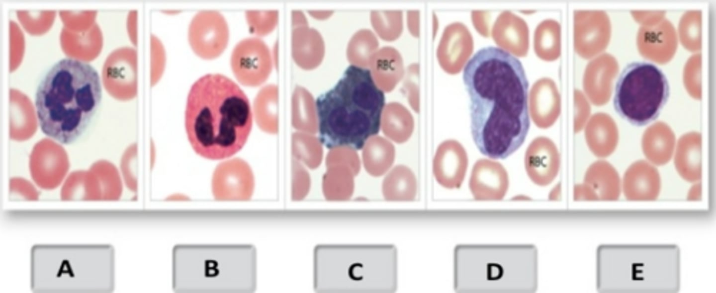 <p>monocyte</p>