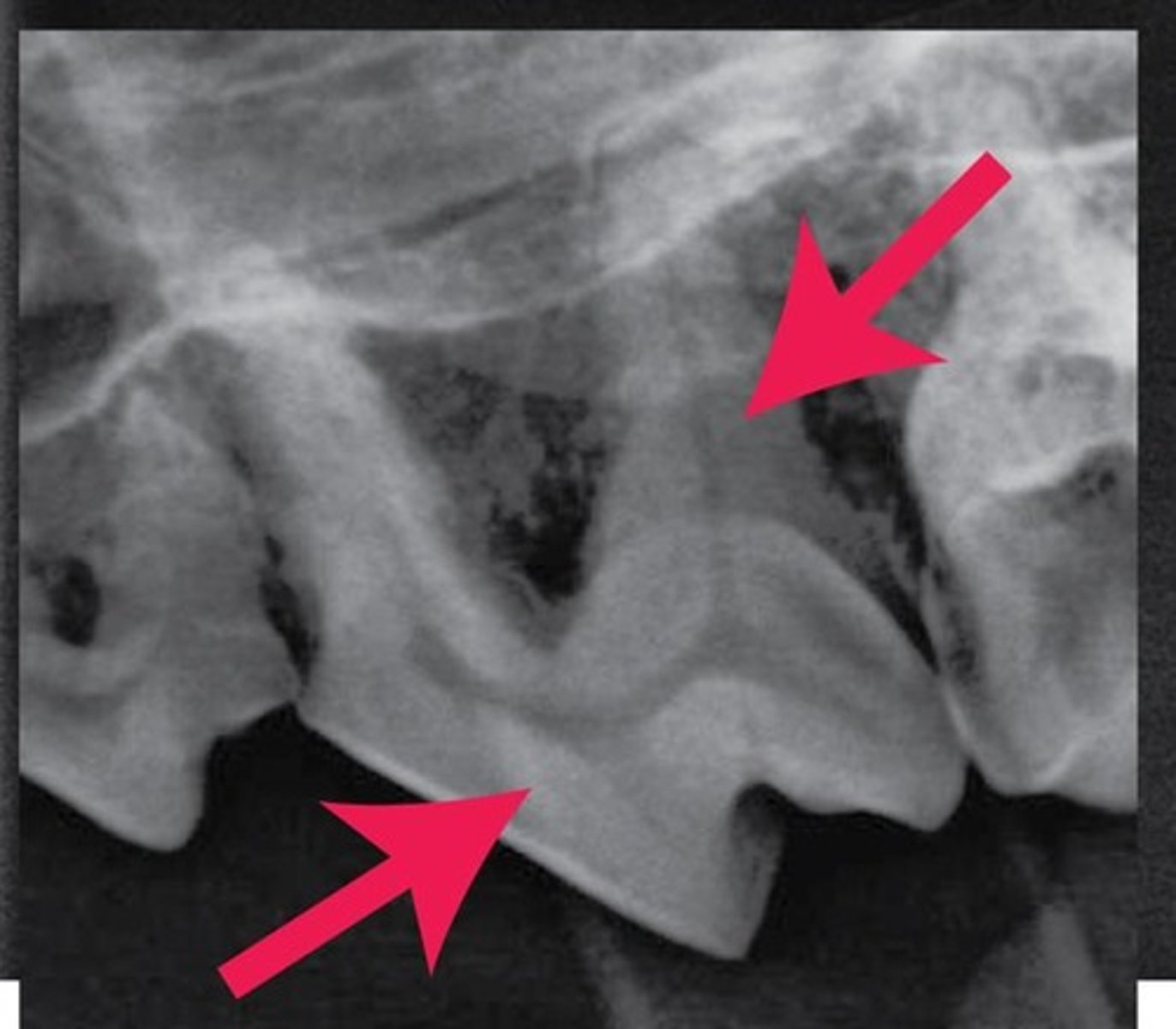 <p>The arrows are pointing to what substance that makes up the bulk of the internal tooth, deep to the enamel and cement?</p>