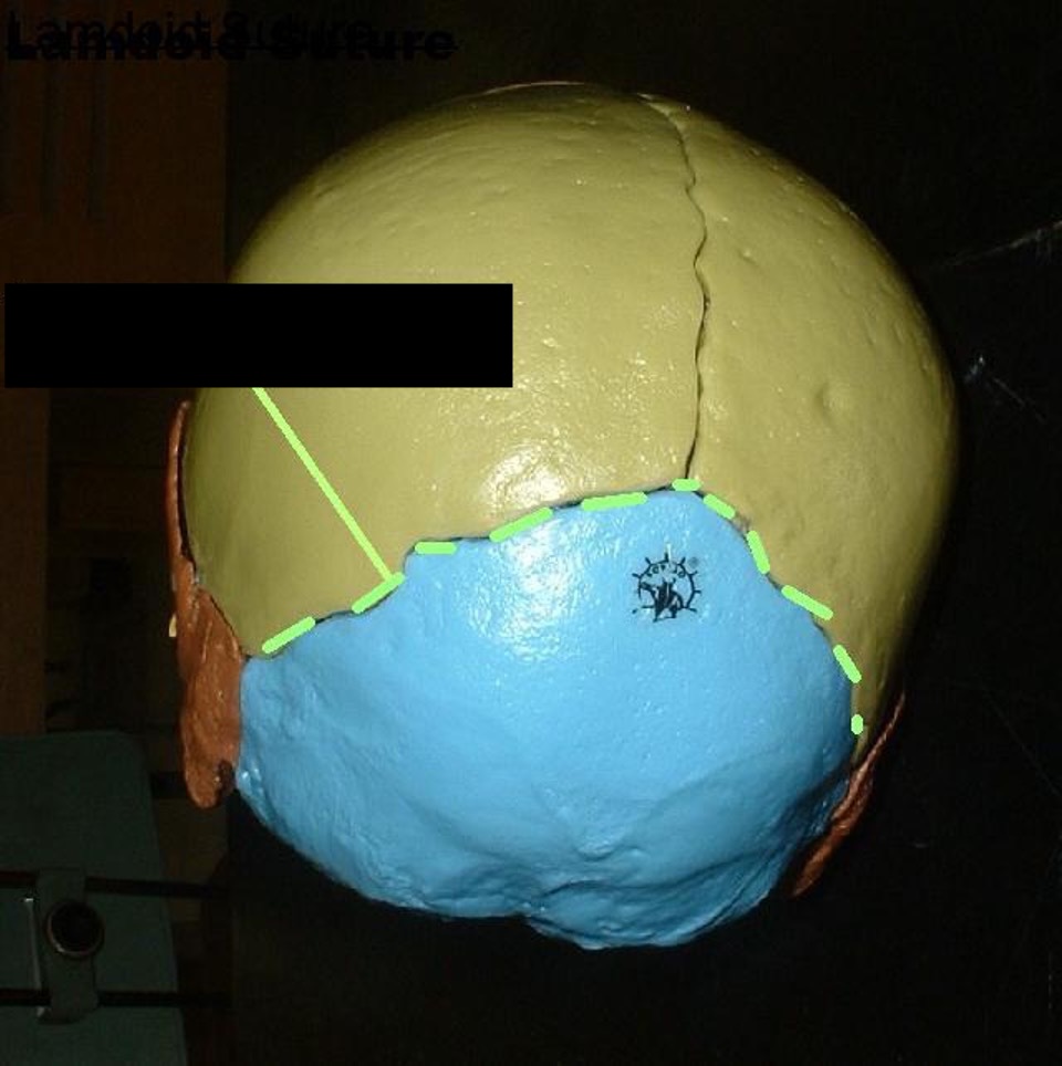 <p>suture separating parietal and occipital bone. (looks like a lambda)</p>